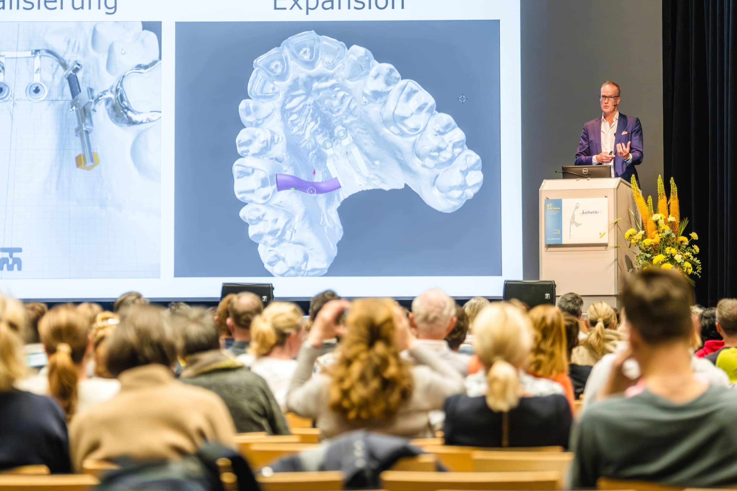 Ein Redner präsentiert den Zuhörern in einem Hörsaal Dias zur dentalen Bildgebung. Die Folien zeigen detaillierte 3D-Darstellungen von Zahnformen, und die Zuhörer hören aufmerksam zu.